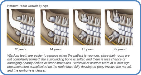 wisdom teeth healing process pictures